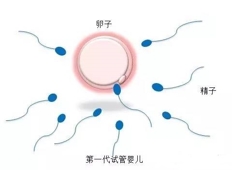 三代试管代怀包生捐卵公司